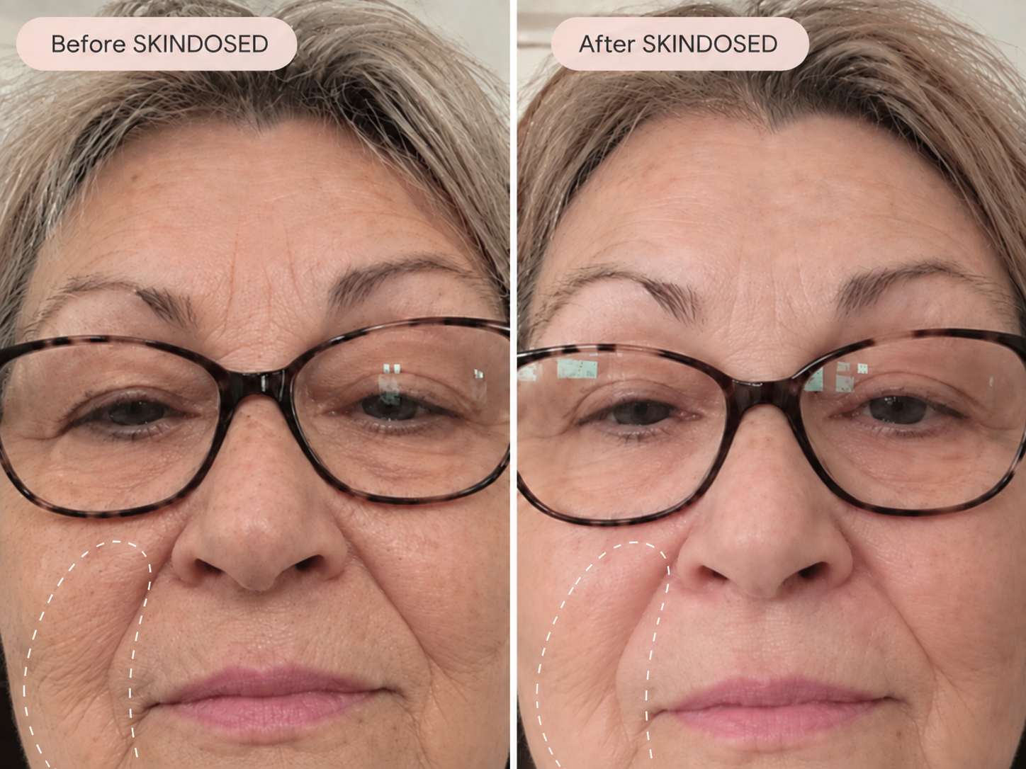 Before and after skincare comparison, image one