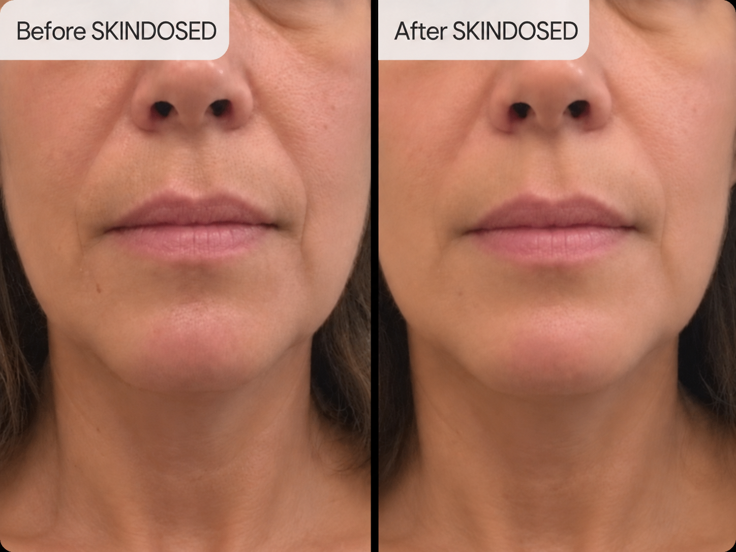 Before and after skincare comparison, image two